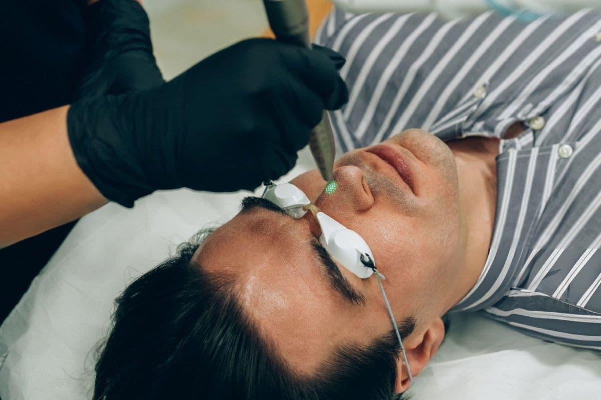 Peeling Wajah untuk Pria: Rahasia Kulit Bebas Kusam dan Jerawat