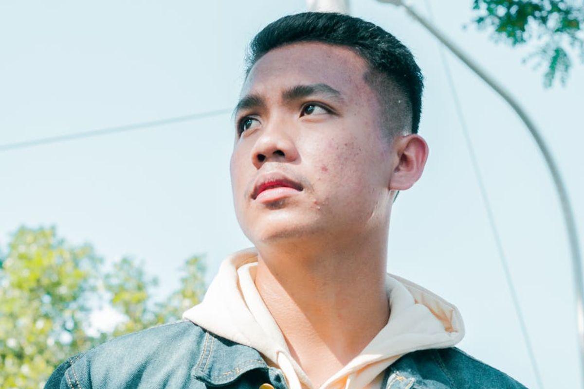 5 Penyebab Wajah Kusam dan Solusi Efektif Mengatasinya