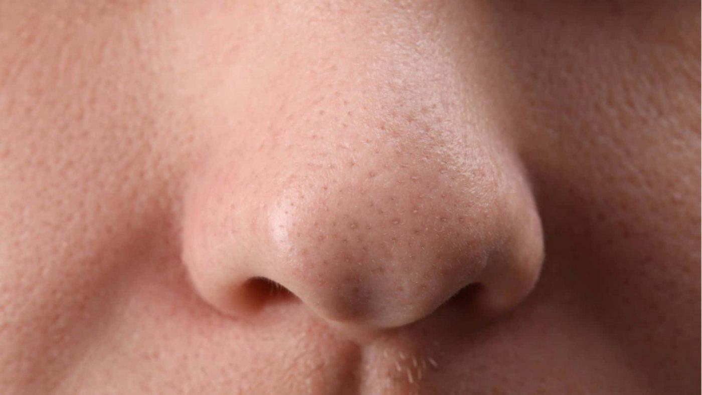 Praktis dan Efektif, 7 Cara Menghilangkan Komedo di Hidung
