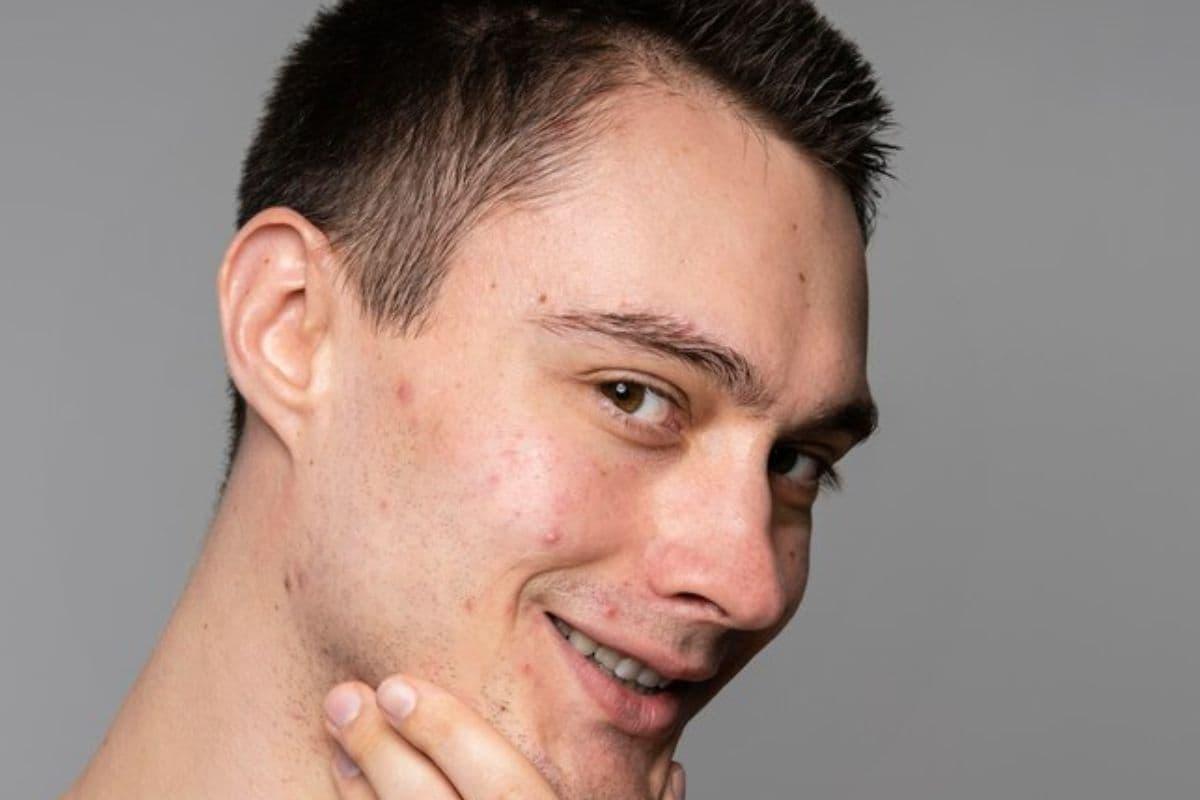 Pria memegang dagunya