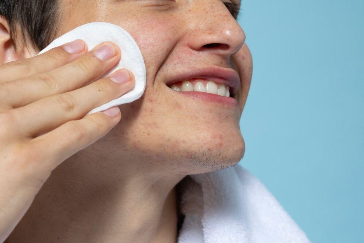 7 Manfaat Toner Wajah dan Cara Penggunaan yang Tepat